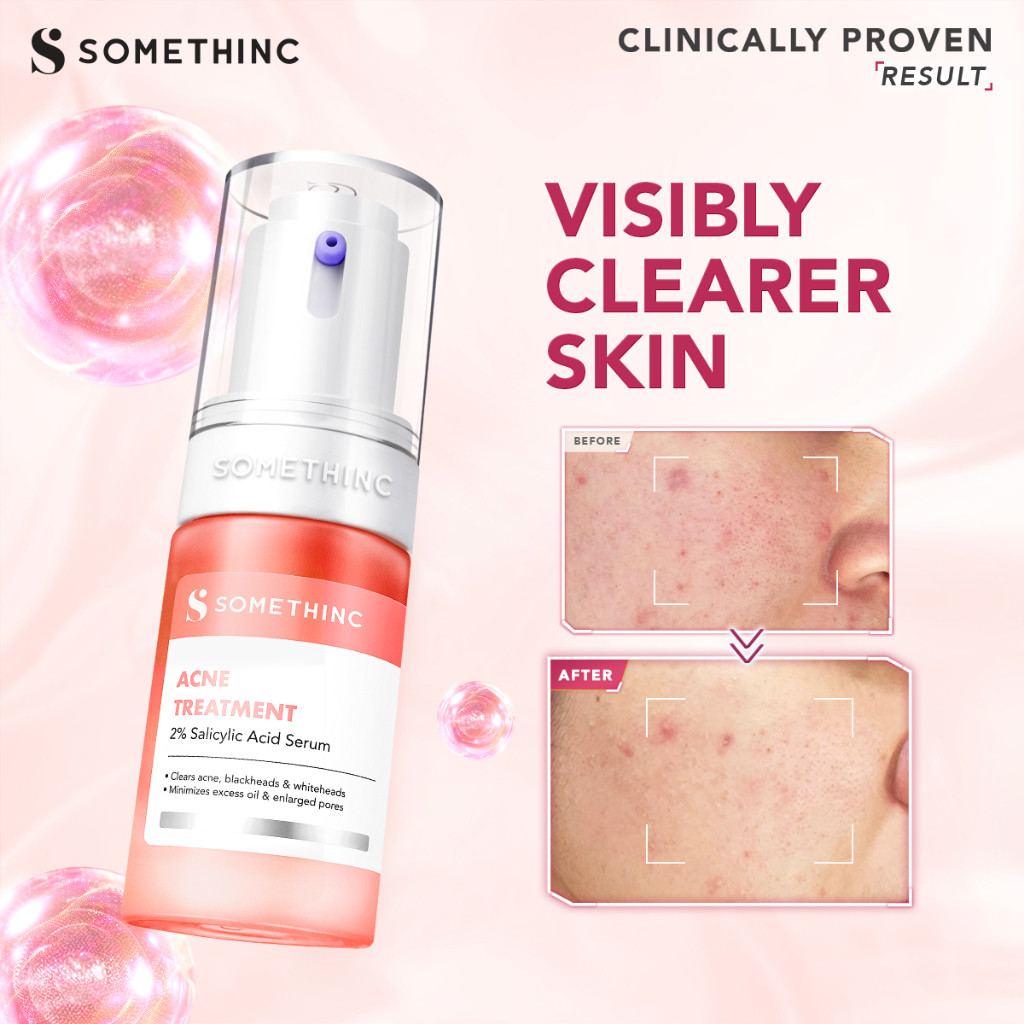 somethinc acne treatment 2% salicylic serum 20ml/serum wajah somethinc acne treatment 2% salicylic serum 20ml/serum wajah