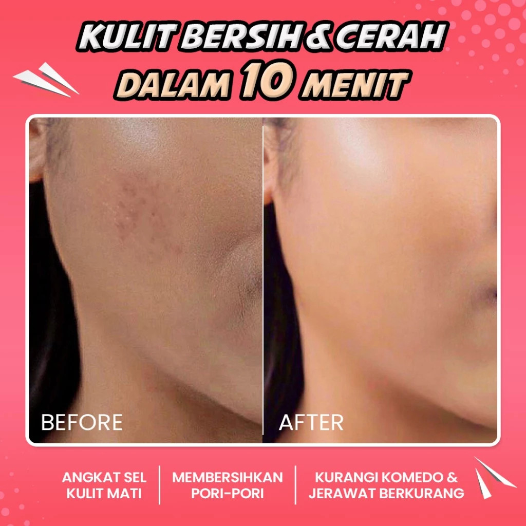 hanasui power peeling serum 20ml / serum eksfoliasi wajah hanasui power peeling serum 20ml / serum eksfoliasi wajah